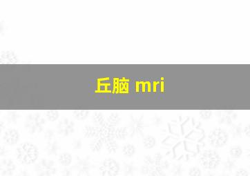 丘脑 mri